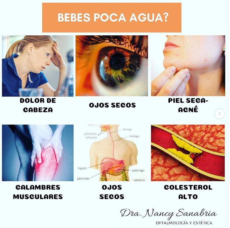 Bebes-poca-agua